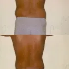 163 üzleti kép ZSÍRLESZÍVÁS KLINIKA DR LÁNYI CECÍLIA Plasztikai sebészet ban/ben Budapest