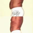 164 üzleti kép ZSÍRLESZÍVÁS KLINIKA DR LÁNYI CECÍLIA Plasztikai sebészet ban/ben Budapest