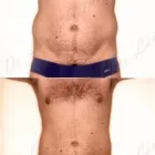 165 üzleti kép ZSÍRLESZÍVÁS KLINIKA DR LÁNYI CECÍLIA Plasztikai sebészet ban/ben Budapest