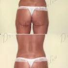 167 üzleti kép ZSÍRLESZÍVÁS KLINIKA DR LÁNYI CECÍLIA Plasztikai sebészet ban/ben Budapest