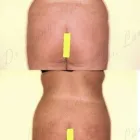 174 üzleti kép ZSÍRLESZÍVÁS KLINIKA DR LÁNYI CECÍLIA Plasztikai sebészet ban/ben Budapest