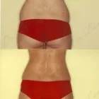 178 üzleti kép ZSÍRLESZÍVÁS KLINIKA DR LÁNYI CECÍLIA Plasztikai sebészet ban/ben Budapest