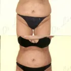 179 üzleti kép ZSÍRLESZÍVÁS KLINIKA DR LÁNYI CECÍLIA Plasztikai sebészet ban/ben Budapest