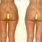 181 üzleti kép ZSÍRLESZÍVÁS KLINIKA DR LÁNYI CECÍLIA Plasztikai sebészet ban/ben Budapest