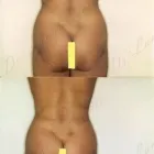 184 üzleti kép ZSÍRLESZÍVÁS KLINIKA DR LÁNYI CECÍLIA Plasztikai sebészet ban/ben Budapest