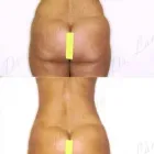 186 üzleti kép ZSÍRLESZÍVÁS KLINIKA DR LÁNYI CECÍLIA Plasztikai sebészet ban/ben Budapest