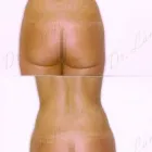 187 üzleti kép ZSÍRLESZÍVÁS KLINIKA DR LÁNYI CECÍLIA Plasztikai sebészet ban/ben Budapest