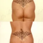 189 üzleti kép ZSÍRLESZÍVÁS KLINIKA DR LÁNYI CECÍLIA Plasztikai sebészet ban/ben Budapest