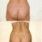 191 üzleti kép ZSÍRLESZÍVÁS KLINIKA DR LÁNYI CECÍLIA Plasztikai sebészet ban/ben Budapest