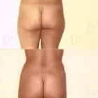 192 üzleti kép ZSÍRLESZÍVÁS KLINIKA DR LÁNYI CECÍLIA Plasztikai sebészet ban/ben Budapest