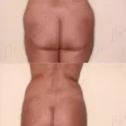 195 üzleti kép ZSÍRLESZÍVÁS KLINIKA DR LÁNYI CECÍLIA Plasztikai sebészet ban/ben Budapest