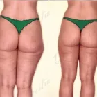 196 üzleti kép ZSÍRLESZÍVÁS KLINIKA DR LÁNYI CECÍLIA Plasztikai sebészet ban/ben Budapest