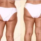 197 üzleti kép ZSÍRLESZÍVÁS KLINIKA DR LÁNYI CECÍLIA Plasztikai sebészet ban/ben Budapest