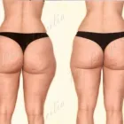 199 üzleti kép ZSÍRLESZÍVÁS KLINIKA DR LÁNYI CECÍLIA Plasztikai sebészet ban/ben Budapest