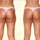 201 üzleti kép ZSÍRLESZÍVÁS KLINIKA DR LÁNYI CECÍLIA Plasztikai sebészet ban/ben Budapest