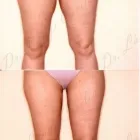 202 üzleti kép ZSÍRLESZÍVÁS KLINIKA DR LÁNYI CECÍLIA Plasztikai sebészet ban/ben Budapest