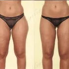 203 üzleti kép ZSÍRLESZÍVÁS KLINIKA DR LÁNYI CECÍLIA Plasztikai sebészet ban/ben Budapest