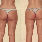 204 üzleti kép ZSÍRLESZÍVÁS KLINIKA DR LÁNYI CECÍLIA Plasztikai sebészet ban/ben Budapest