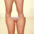 205 üzleti kép ZSÍRLESZÍVÁS KLINIKA DR LÁNYI CECÍLIA Plasztikai sebészet ban/ben Budapest