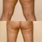 206 üzleti kép ZSÍRLESZÍVÁS KLINIKA DR LÁNYI CECÍLIA Plasztikai sebészet ban/ben Budapest