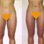 207 üzleti kép ZSÍRLESZÍVÁS KLINIKA DR LÁNYI CECÍLIA Plasztikai sebészet ban/ben Budapest