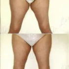 208 üzleti kép ZSÍRLESZÍVÁS KLINIKA DR LÁNYI CECÍLIA Plasztikai sebészet ban/ben Budapest