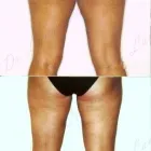 212 üzleti kép ZSÍRLESZÍVÁS KLINIKA DR LÁNYI CECÍLIA Plasztikai sebészet ban/ben Budapest