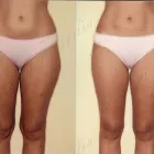 215 üzleti kép ZSÍRLESZÍVÁS KLINIKA DR LÁNYI CECÍLIA Plasztikai sebészet ban/ben Budapest