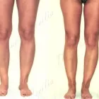 217 üzleti kép ZSÍRLESZÍVÁS KLINIKA DR LÁNYI CECÍLIA Plasztikai sebészet ban/ben Budapest