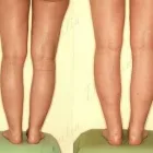 221 üzleti kép ZSÍRLESZÍVÁS KLINIKA DR LÁNYI CECÍLIA Plasztikai sebészet ban/ben Budapest