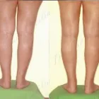 222 üzleti kép ZSÍRLESZÍVÁS KLINIKA DR LÁNYI CECÍLIA Plasztikai sebészet ban/ben Budapest