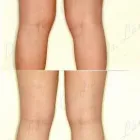 226 üzleti kép ZSÍRLESZÍVÁS KLINIKA DR LÁNYI CECÍLIA Plasztikai sebészet ban/ben Budapest