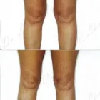 227 üzleti kép ZSÍRLESZÍVÁS KLINIKA DR LÁNYI CECÍLIA Plasztikai sebészet ban/ben Budapest