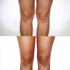 228 üzleti kép ZSÍRLESZÍVÁS KLINIKA DR LÁNYI CECÍLIA Plasztikai sebészet ban/ben Budapest