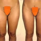 229 üzleti kép ZSÍRLESZÍVÁS KLINIKA DR LÁNYI CECÍLIA Plasztikai sebészet ban/ben Budapest