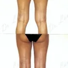 230 üzleti kép ZSÍRLESZÍVÁS KLINIKA DR LÁNYI CECÍLIA Plasztikai sebészet ban/ben Budapest