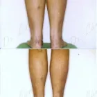 231 üzleti kép ZSÍRLESZÍVÁS KLINIKA DR LÁNYI CECÍLIA Plasztikai sebészet ban/ben Budapest