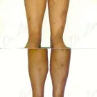 232 üzleti kép ZSÍRLESZÍVÁS KLINIKA DR LÁNYI CECÍLIA Plasztikai sebészet ban/ben Budapest