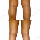 233 üzleti kép ZSÍRLESZÍVÁS KLINIKA DR LÁNYI CECÍLIA Plasztikai sebészet ban/ben Budapest