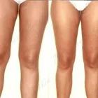 235 üzleti kép ZSÍRLESZÍVÁS KLINIKA DR LÁNYI CECÍLIA Plasztikai sebészet ban/ben Budapest