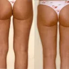 237 üzleti kép ZSÍRLESZÍVÁS KLINIKA DR LÁNYI CECÍLIA Plasztikai sebészet ban/ben Budapest