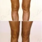 238 üzleti kép ZSÍRLESZÍVÁS KLINIKA DR LÁNYI CECÍLIA Plasztikai sebészet ban/ben Budapest