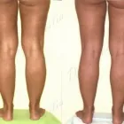 239 üzleti kép ZSÍRLESZÍVÁS KLINIKA DR LÁNYI CECÍLIA Plasztikai sebészet ban/ben Budapest