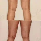 240 üzleti kép ZSÍRLESZÍVÁS KLINIKA DR LÁNYI CECÍLIA Plasztikai sebészet ban/ben Budapest