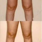 241 üzleti kép ZSÍRLESZÍVÁS KLINIKA DR LÁNYI CECÍLIA Plasztikai sebészet ban/ben Budapest