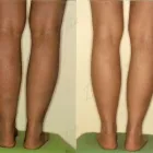 243 üzleti kép ZSÍRLESZÍVÁS KLINIKA DR LÁNYI CECÍLIA Plasztikai sebészet ban/ben Budapest