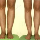 244 üzleti kép ZSÍRLESZÍVÁS KLINIKA DR LÁNYI CECÍLIA Plasztikai sebészet ban/ben Budapest