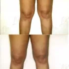 245 üzleti kép ZSÍRLESZÍVÁS KLINIKA DR LÁNYI CECÍLIA Plasztikai sebészet ban/ben Budapest