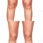 247 üzleti kép ZSÍRLESZÍVÁS KLINIKA DR LÁNYI CECÍLIA Plasztikai sebészet ban/ben Budapest