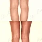 250 üzleti kép ZSÍRLESZÍVÁS KLINIKA DR LÁNYI CECÍLIA Plasztikai sebészet ban/ben Budapest